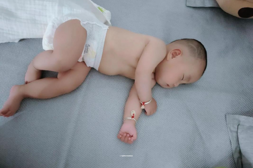 江阴六个月宝宝眼睛散光